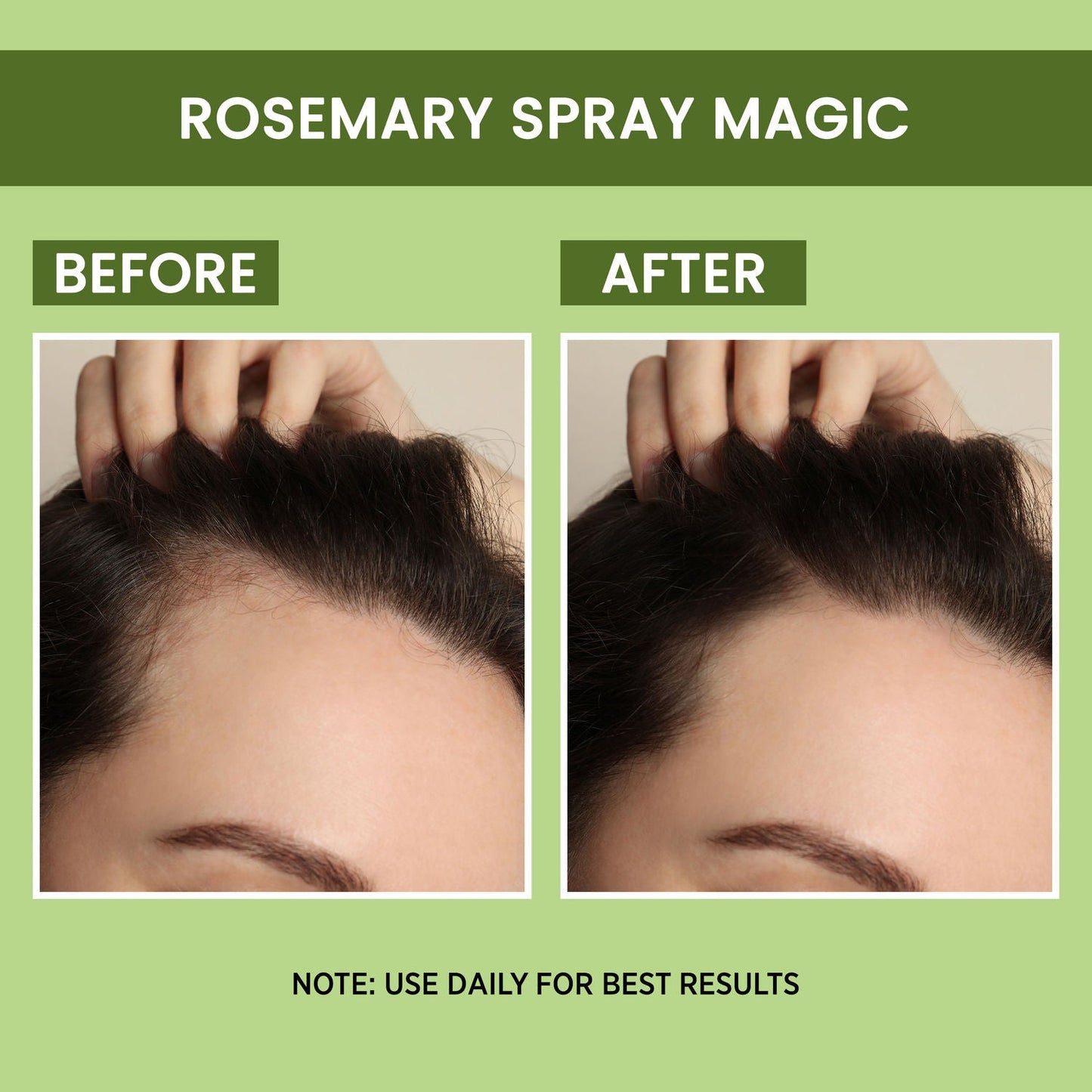 Rosemary Water, Hair Spray For Regrowth (Pack of 2)